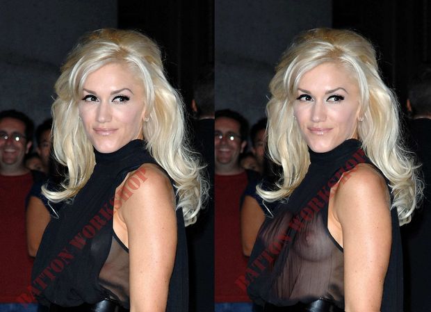 Gwen Stefani x-ray 01