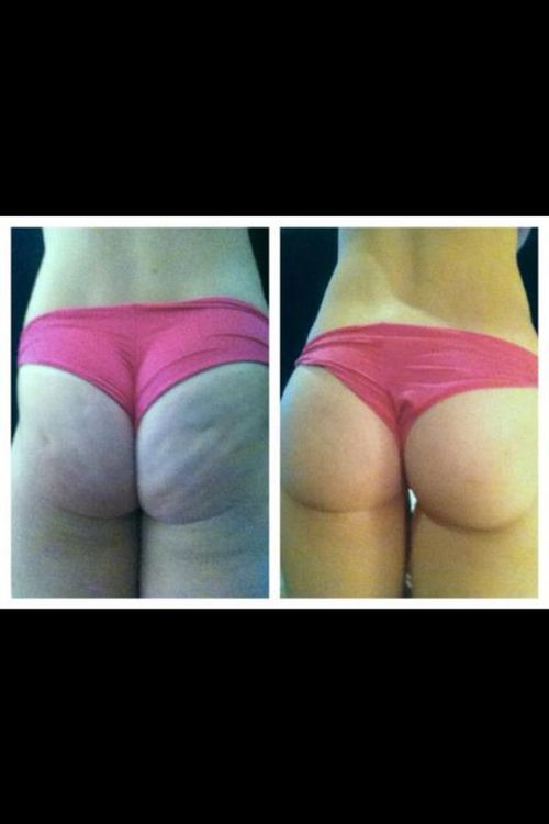 Hot photo