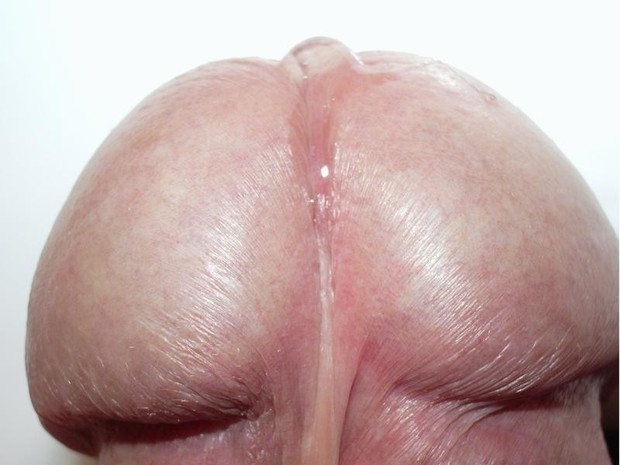 DiCKHEAd.
