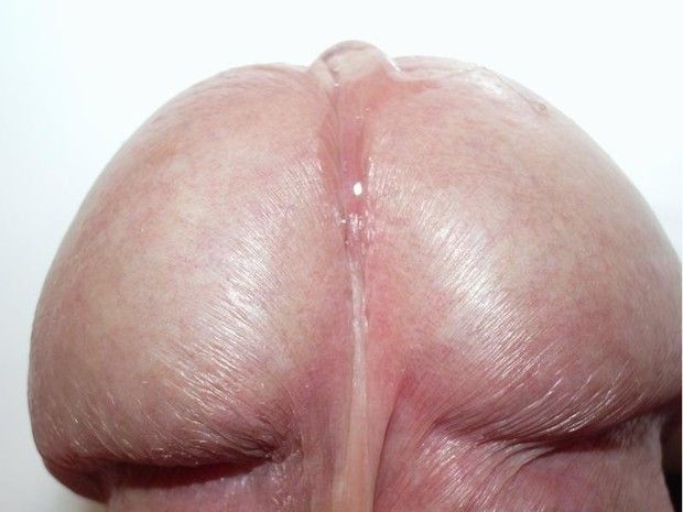 DiCKHEAd.