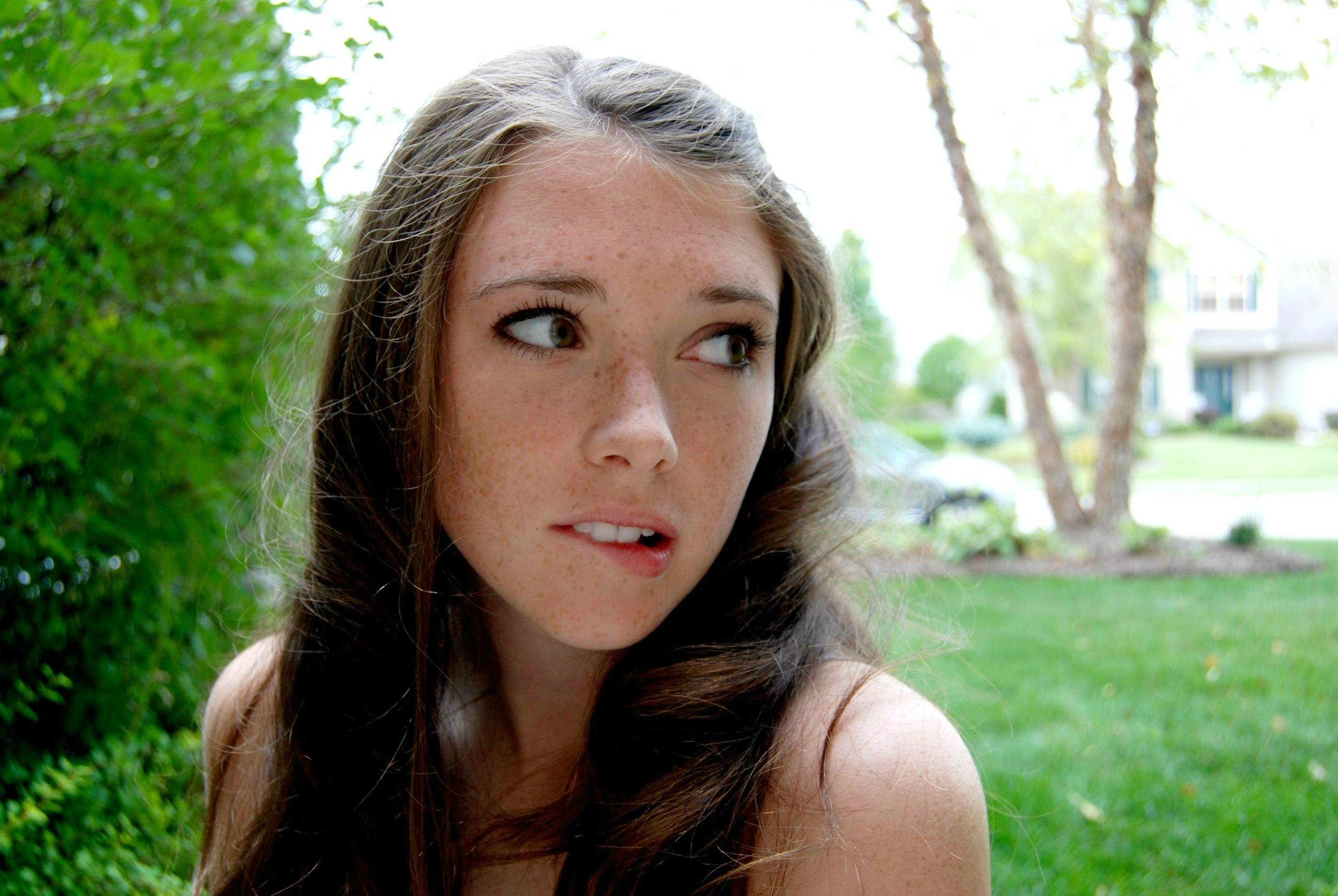 Freckles