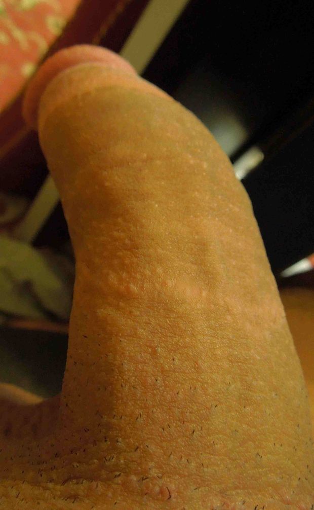 My Dick
