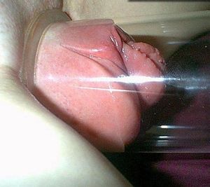 incredible pumped pussy