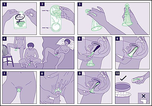 Learn to Use Female Condoms