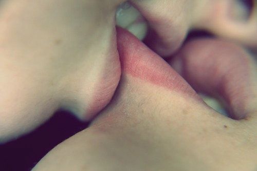 Kiss