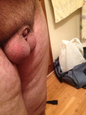 Smallest Penis on Earth has been found!