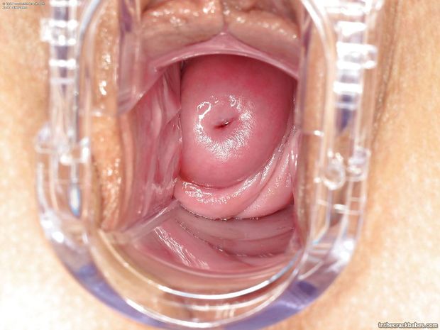 Speculum closeup