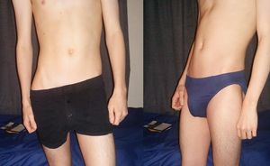 Guys Boxers or briefs