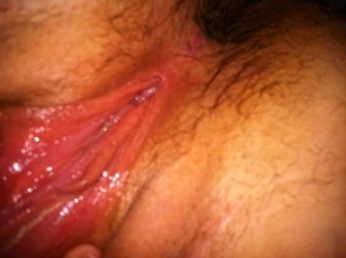 Hairy macro grool