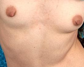 wife nipples