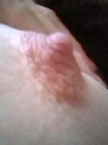 nip
