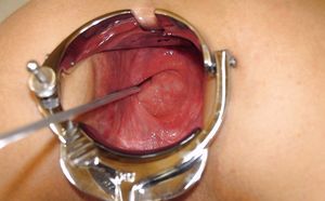 Horse speculum in ass