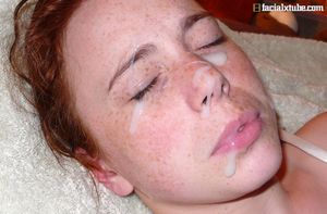 redhead facial
