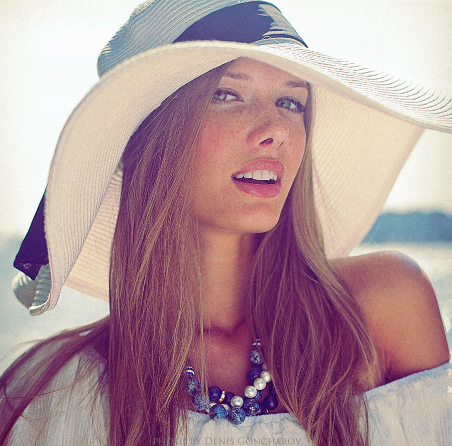 freckles