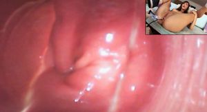 Holly Michaels has a camera penetrated he speculumed ass to inspect all of her sensitive anal glands