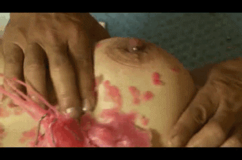Squeezed after wax