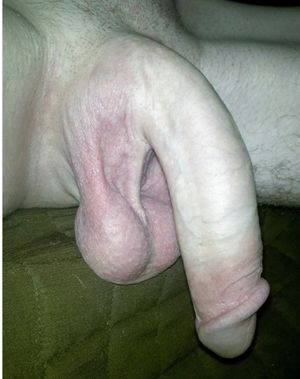 Mr. Giant Sack of Balls