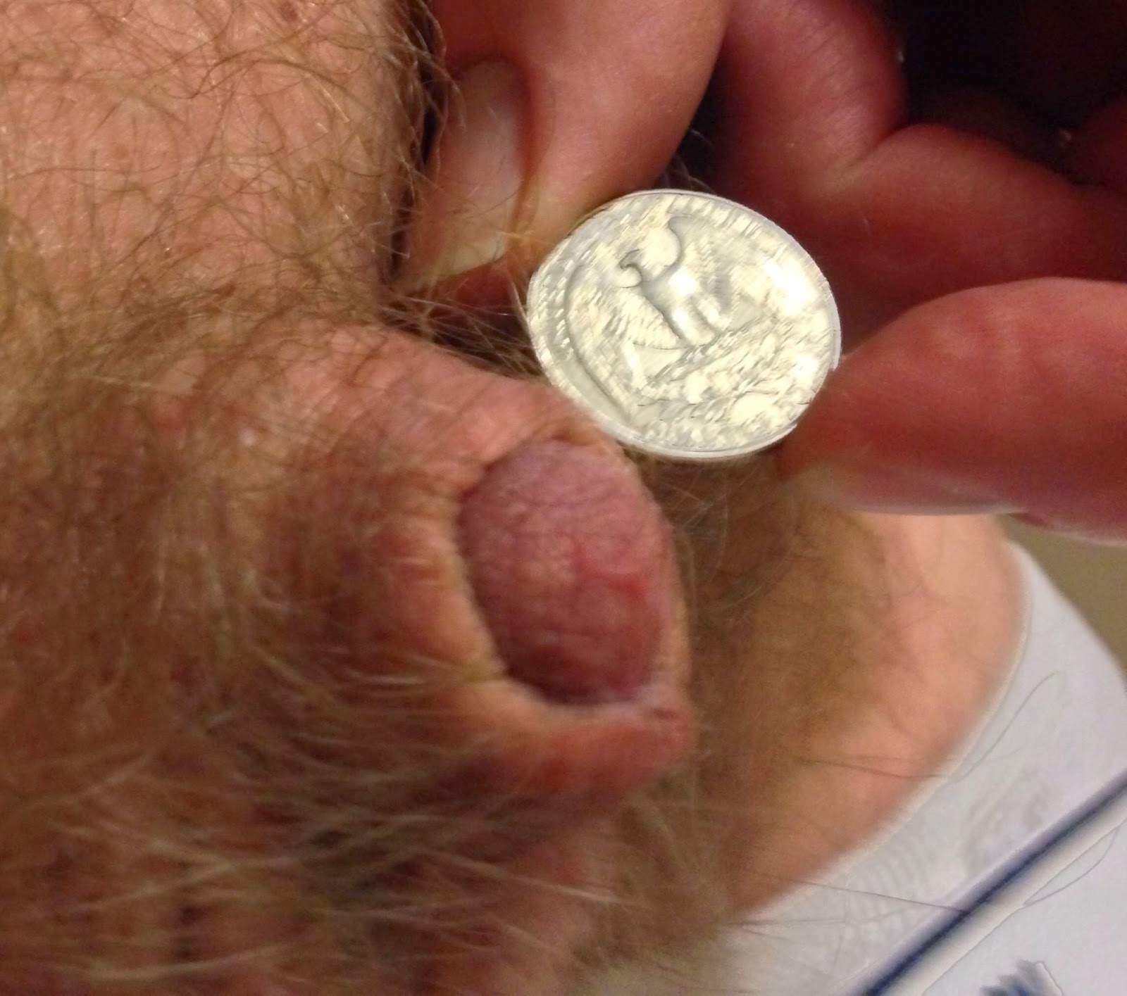 tinus micropenis