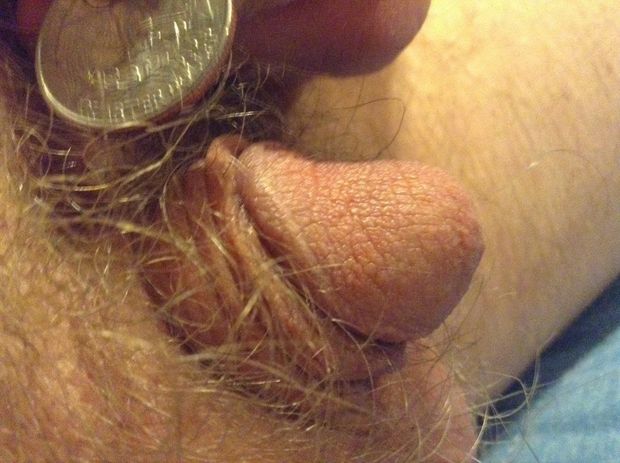 tiny micropenis vs coin