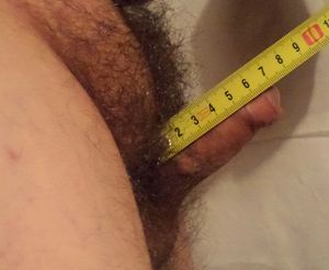 7 cm long micropenis