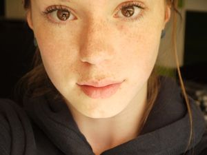 gorgeous young freckled face