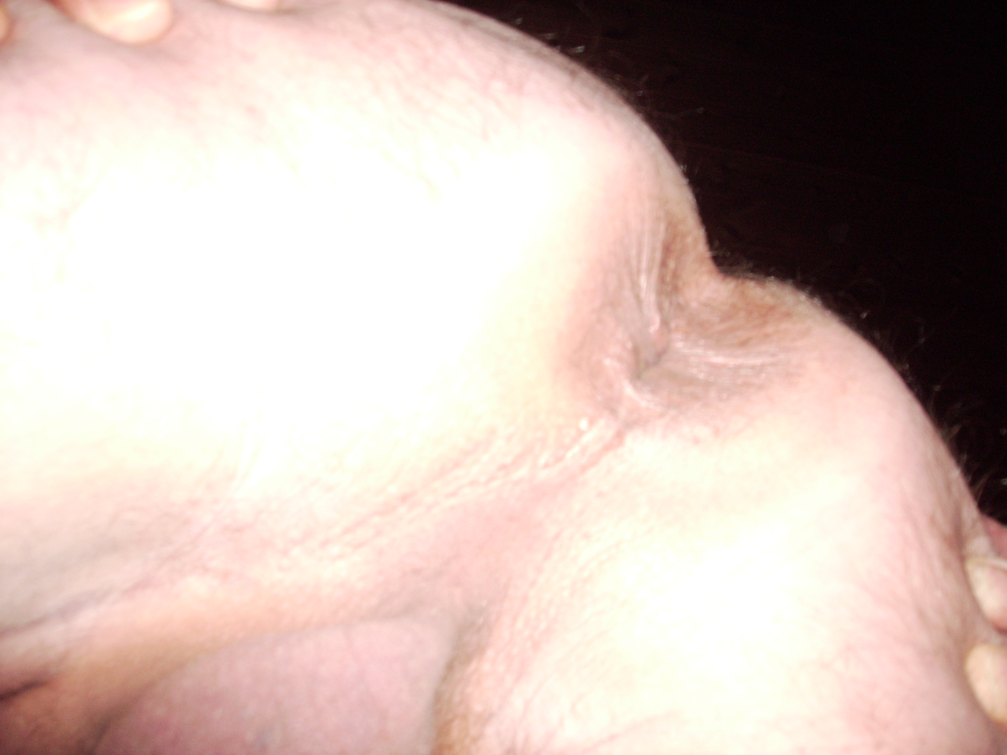 My Hole