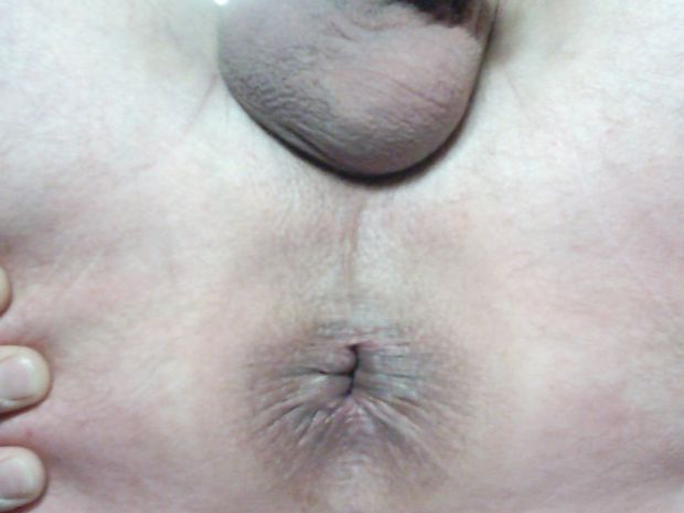My softly Ass-Hole