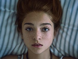 stunning freckled girl