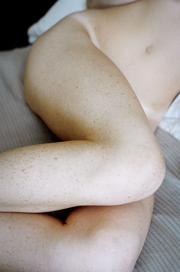amazing freckled legs