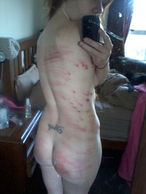 Marks Amateur Bdsm The Home Selfshot Marked Bruised