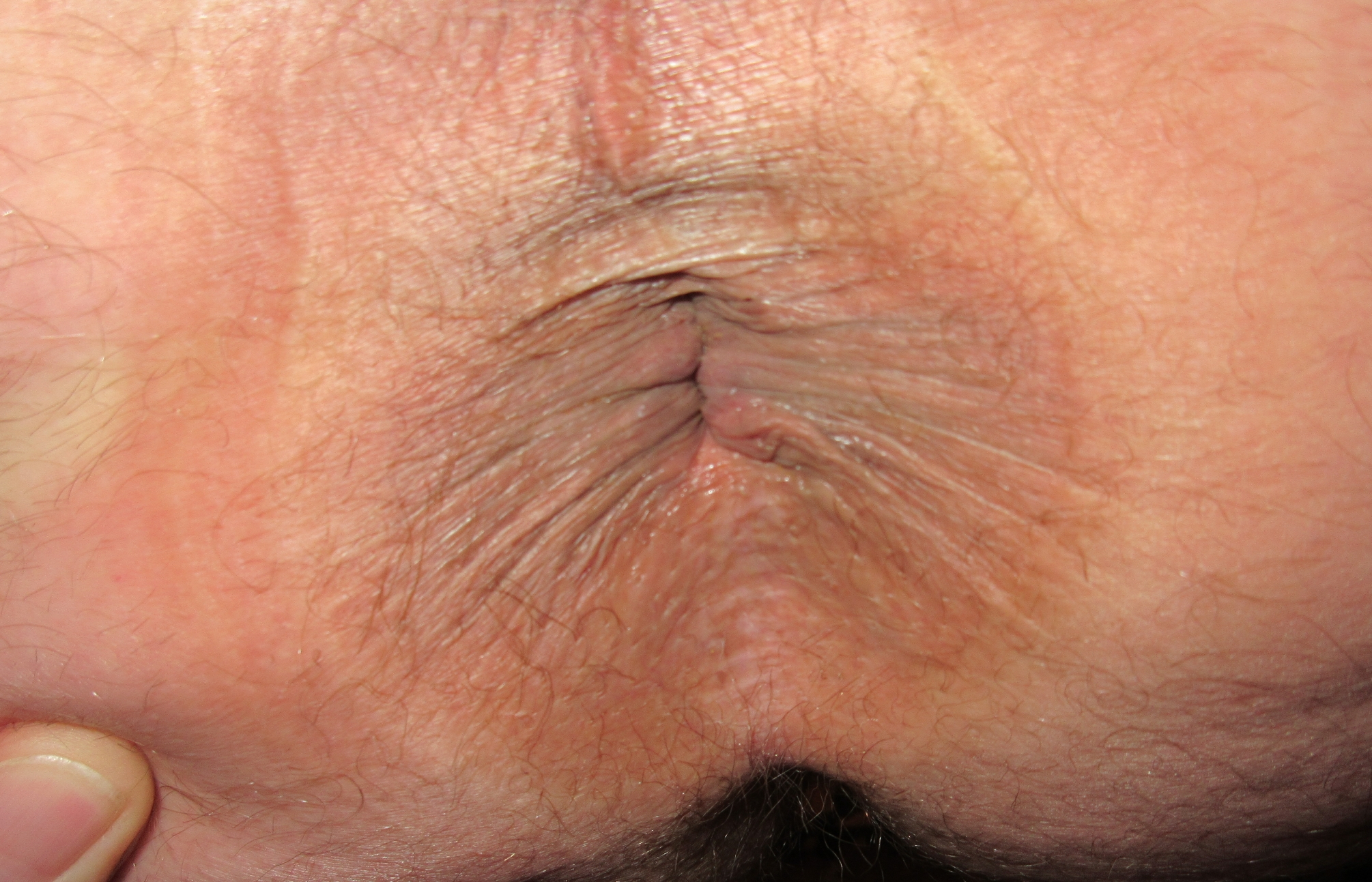 My softly Ass-Hole