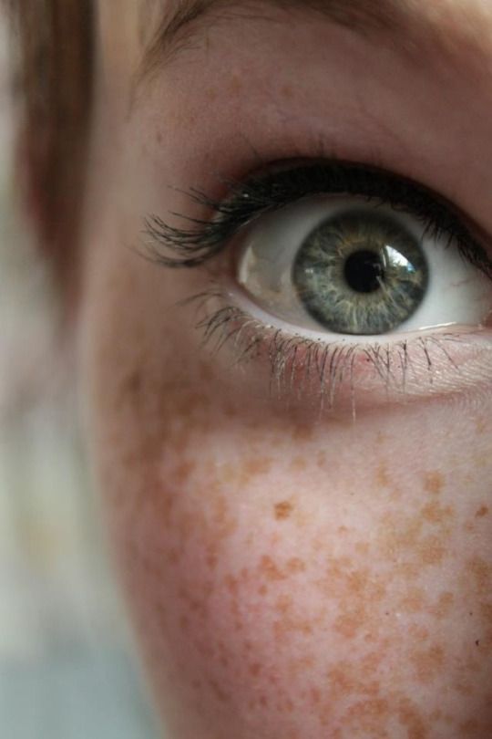 green eyed freckled chick