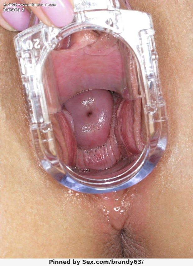 Glass Spreader