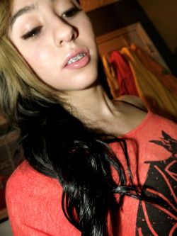 Braces And Lip Gloss