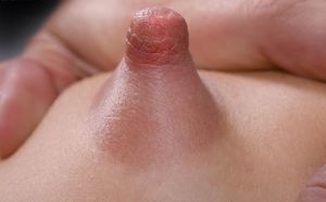 Close-up pic of a very erect puffy nipple