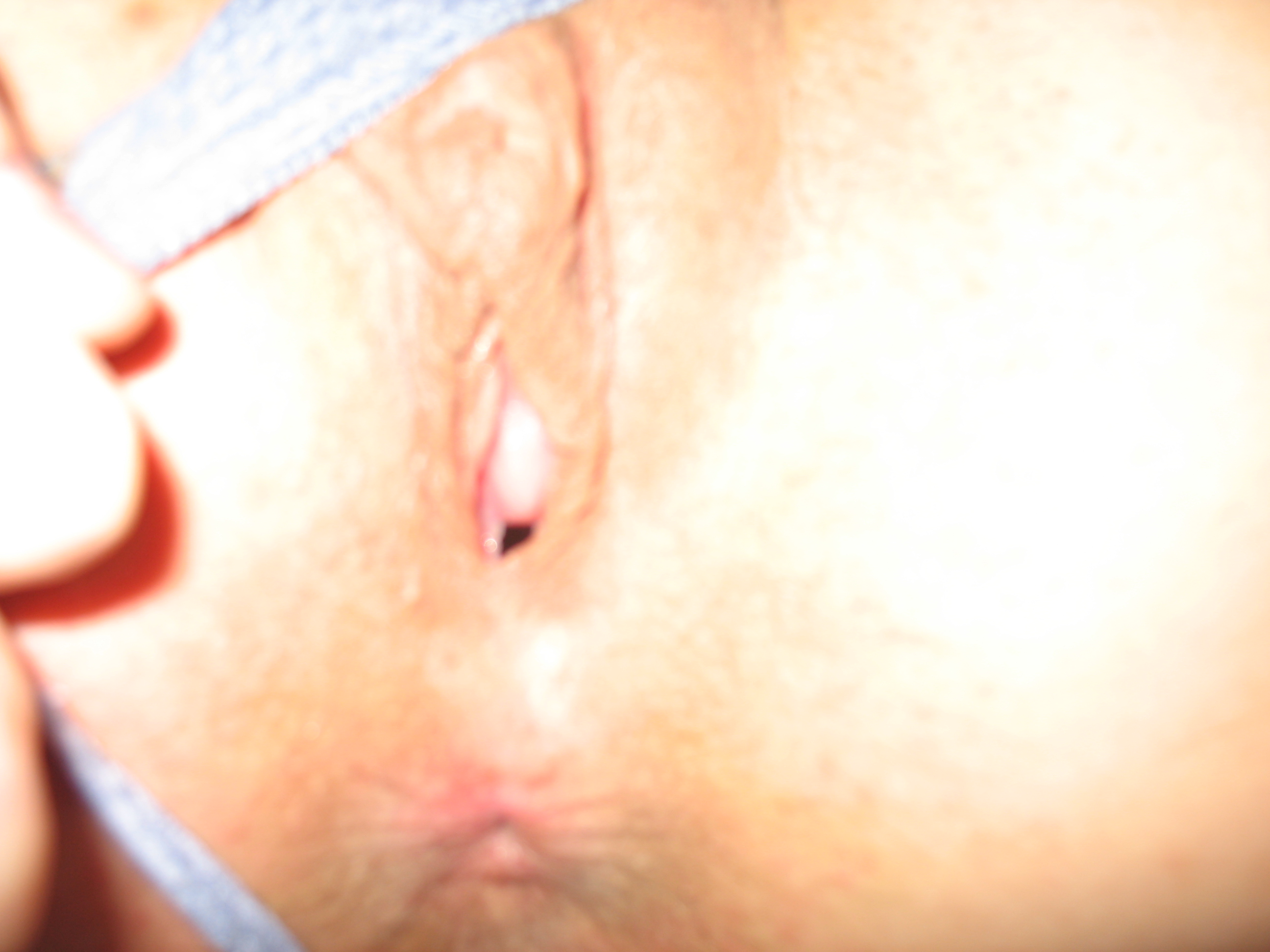 tiny hole ;)