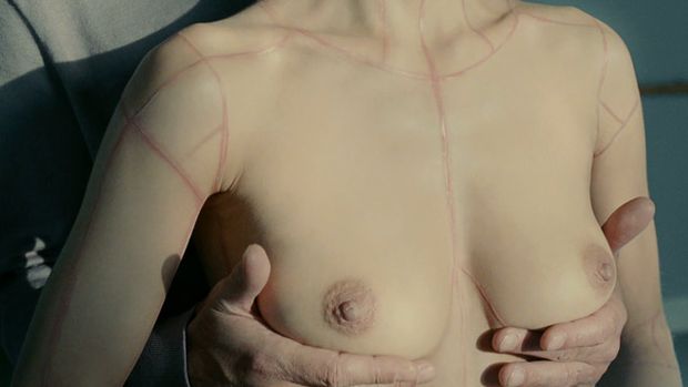 Women with Scars