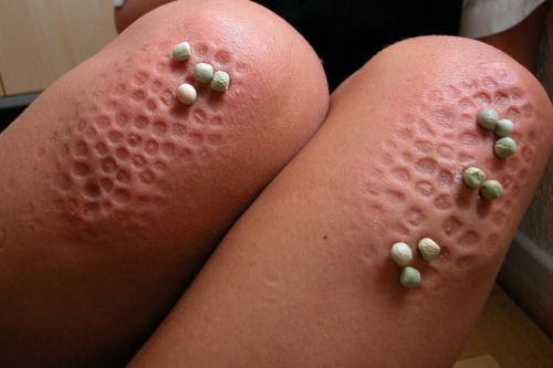 The results from cornertime kneeling on dried peas