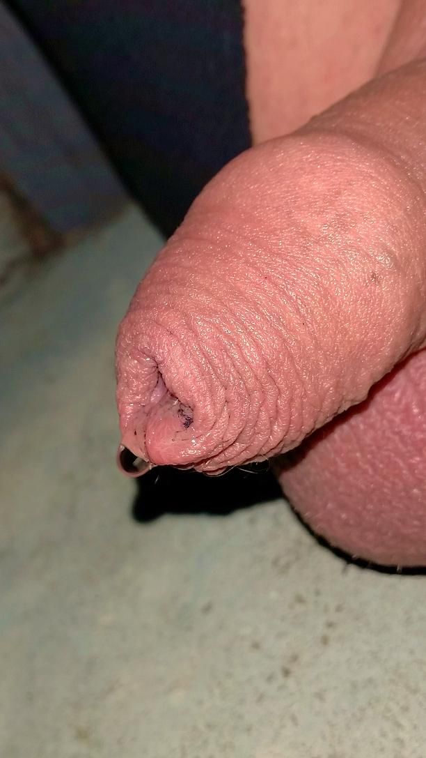 my dick