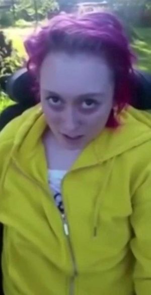 Amy Thomson who was left in a wheelchair after taking MDMA.