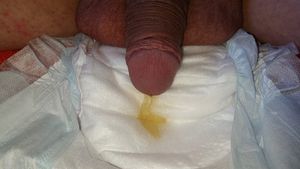 me peeing in the diaper