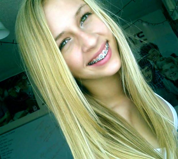 Small titet teen with braces