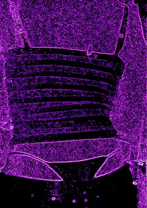 Teen neon whaletail!