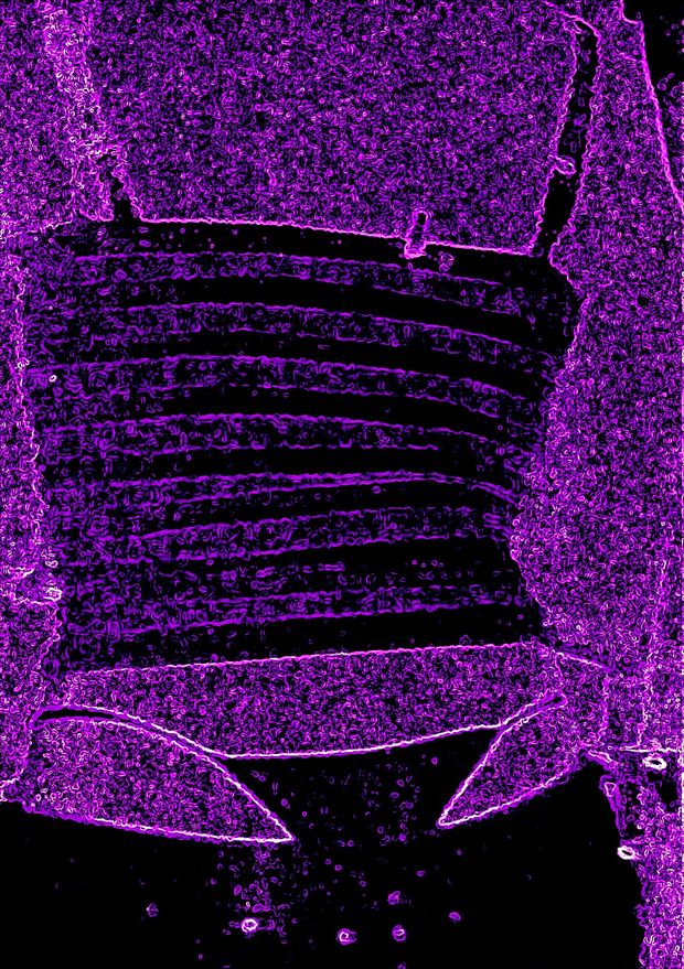 Teen neon whaletail!