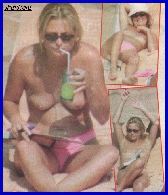 Philippa Forrester topless on a beach paparazzi photo