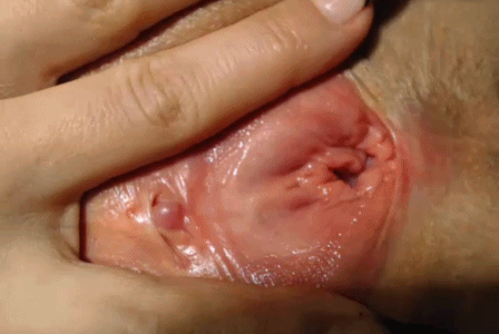 close up