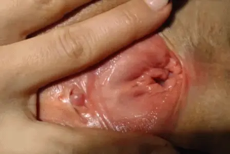 close up