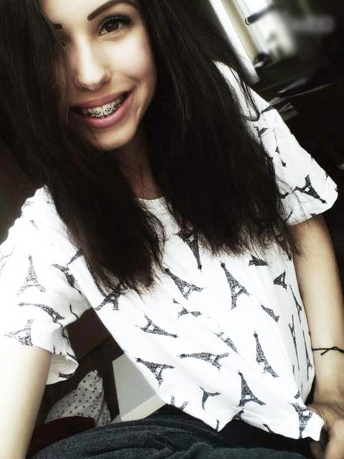 Brunette braces selfie
