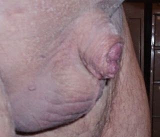 shaftless microdick