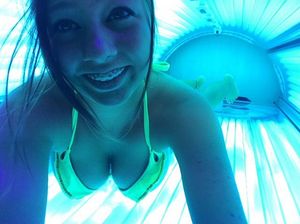 braceface - Getting tanned